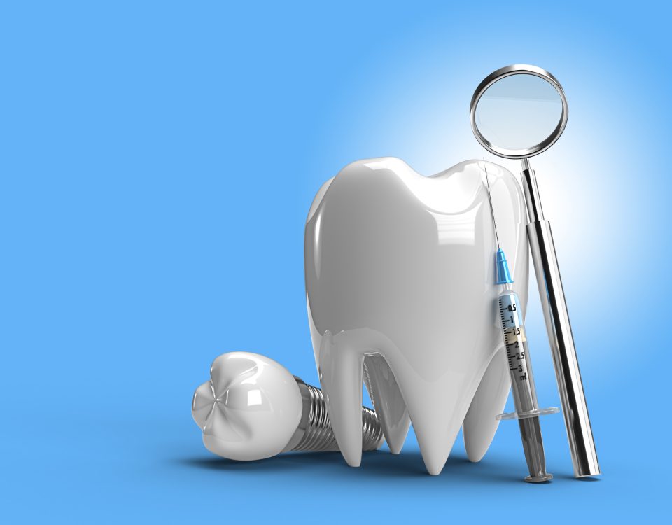 implant-dentar-romania-rapid
